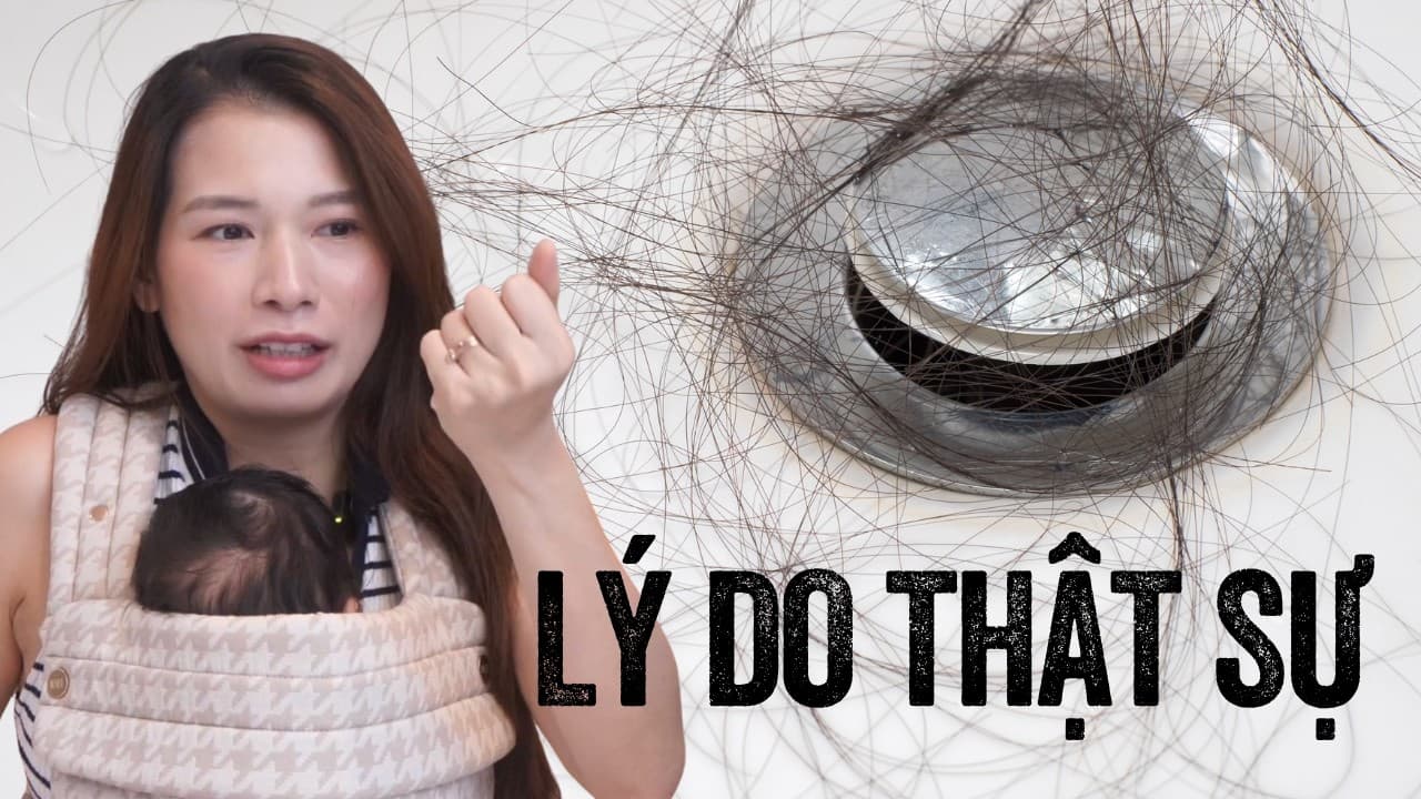 Sai lầm giảm cân khiến chị em bị rụng tóc hàng loạt