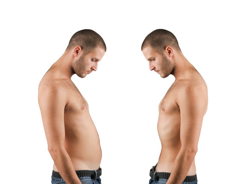 Tạng người Skinny fat: Nguyên nhân, dấu hiệu nhận biết và cách khắc phục?